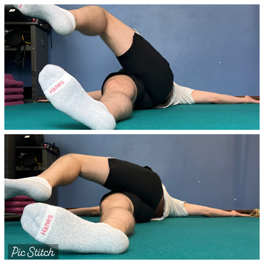 Before and after comparison of Frank’s affected hip rotation in supine position following hip surgery in Arlington, showing dramatic improvement after targeted treatment.