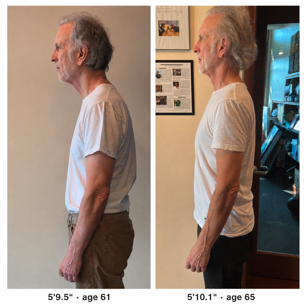 David's approved side-by-side posture transformation at ages 61 and 65.